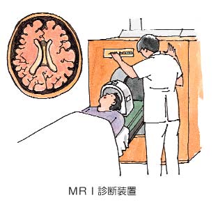 MRI診断装置