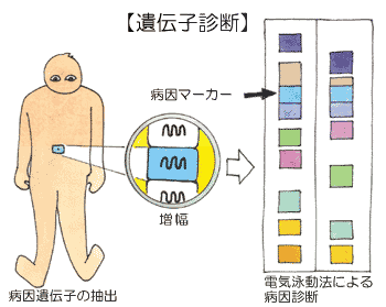 遺伝子診断