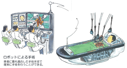 ロボットによる手術